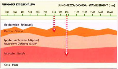 descrizione funzionamento laserterapia di potenza