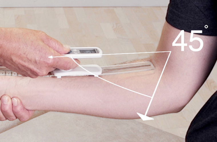 EasyAngle per misurare le articolazioni