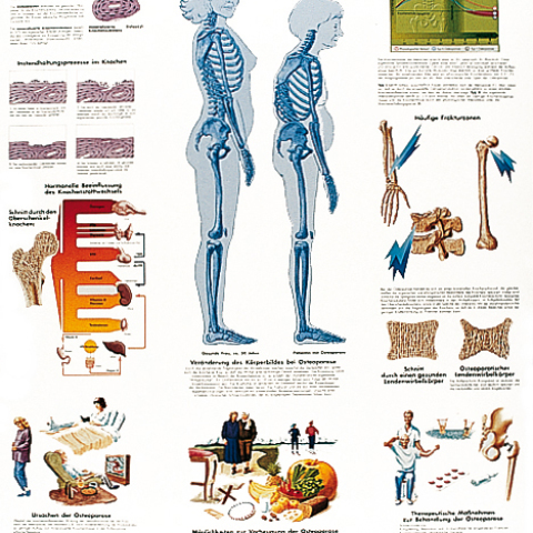 VR4121 - POSTER OSTEOPOROSI 